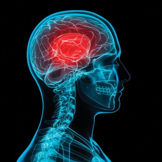 Northern Health praises new CATT online tool to help detect and prevent concussions