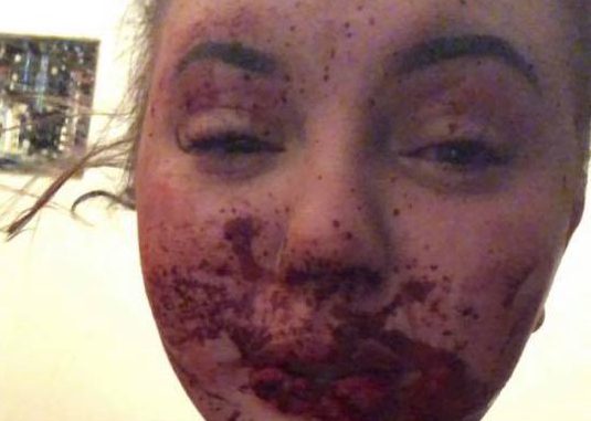 Prince George woman claims she was attacked, had lip bitten off