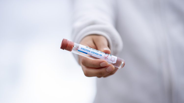 Active COVID-19 cases in BC drops to 2,100